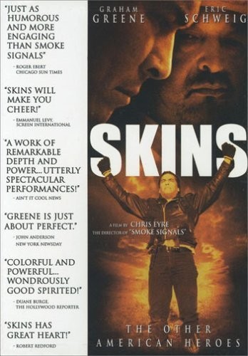 Skins (2002) afişi Skins (2002) afişi