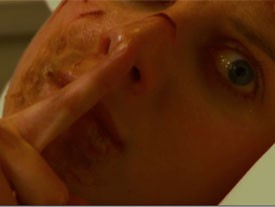 Patient 17 Fotoğrafı