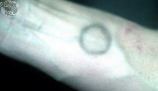 Halka(lar) Fotoğrafı