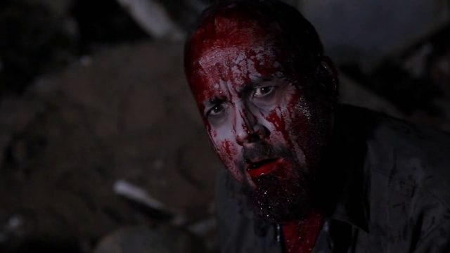 Bite Marks Fotoğrafı