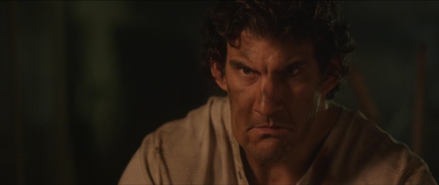 Septic Man Fotoğrafı