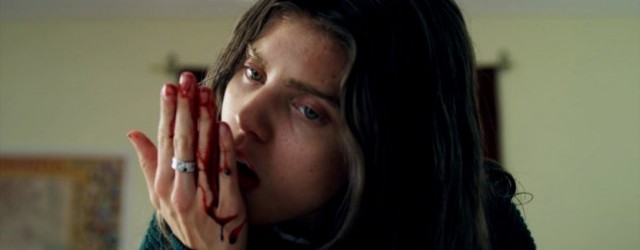 Eksizyon fotoğrafı