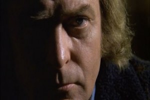 Kesik El Fotoğrafı