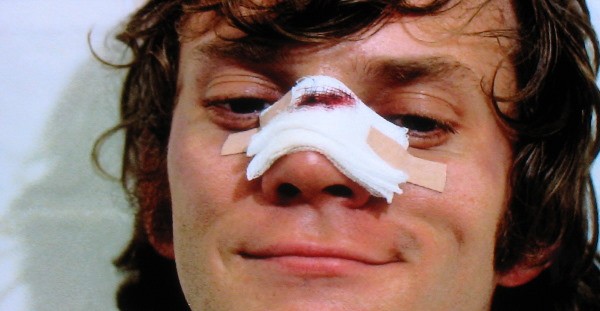 Otomatik Portakal Fotoğrafı