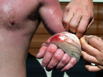 Knuckle Fotoğrafı
