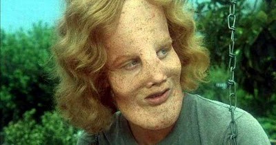 Maske Fotoğrafı