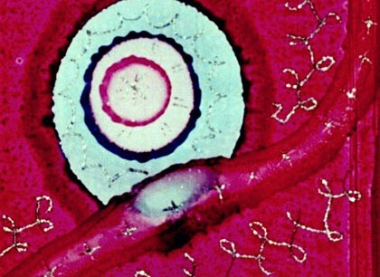 Begone Dull Care Fotoğrafı